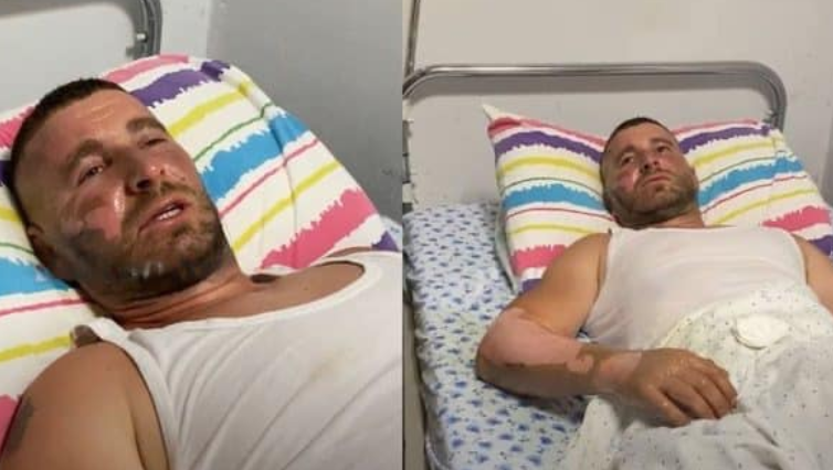 Zjarrfikësi nga Përmeti digjet pjesërisht në trup dhe në fytyrë, flet nga krevati i spitalit: Kemi luftuar për orë të tëra…
